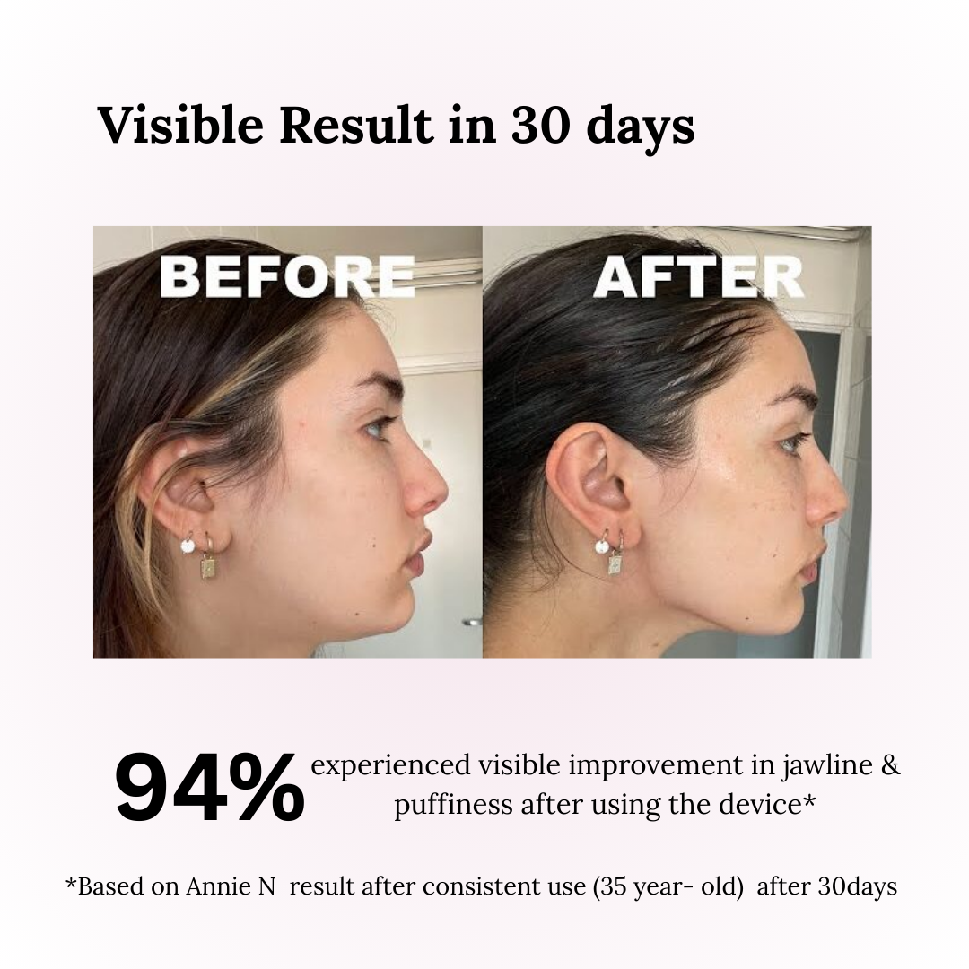 "V-Glow Pro Face Massager™